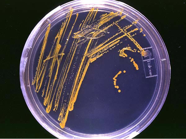 Agar_plate_with_colonies