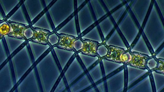 chaetoceros_atlanticus_mmontresor_p