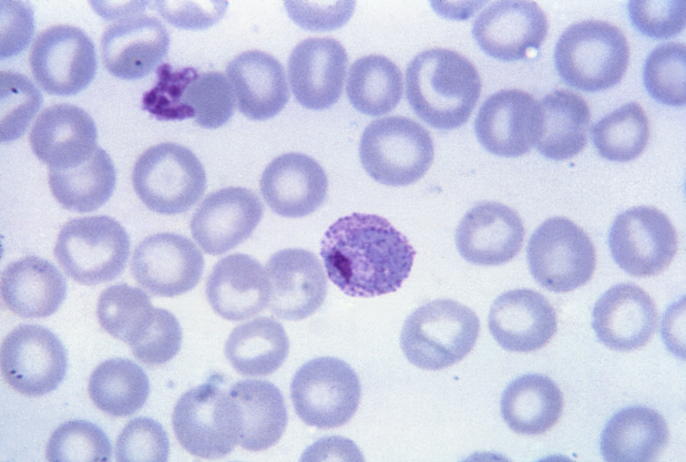 Plasmodium_vivax_01