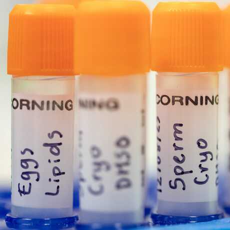 Vials of frozen coral eggs and sperm in the Coral Regeneration Lab. Photo by Gayle Laird